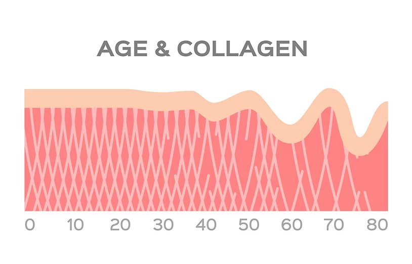 facial line folds infographic