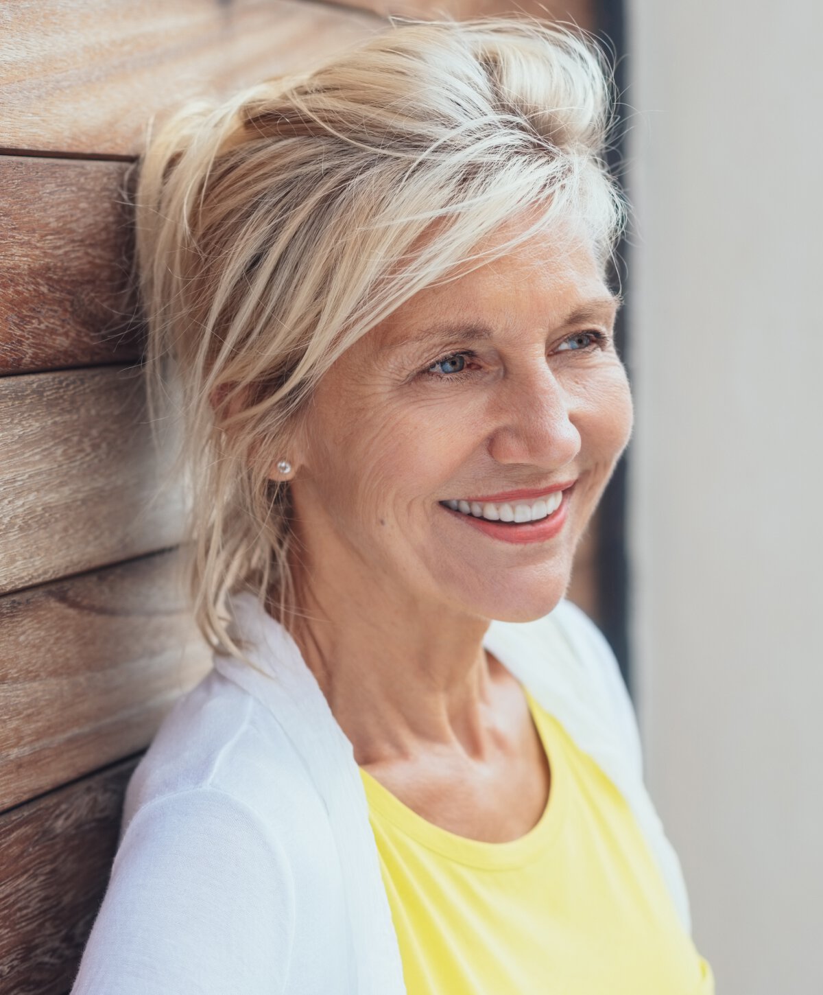 Petaluma acne treatment model smiling