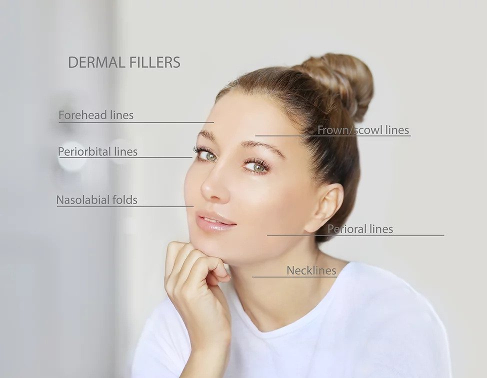 Petaluma wrinkle treatment model smiling